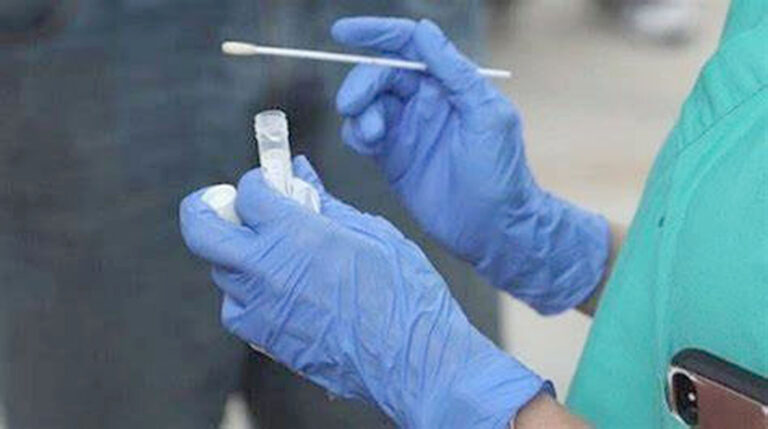 Informaron que los casos de coronavirus no tuvieron modificaciones en las cifras