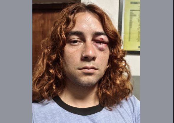 La Violencia Política Escala en Formosa: Graves acusaciones tras la agresión a un influencer de LLA