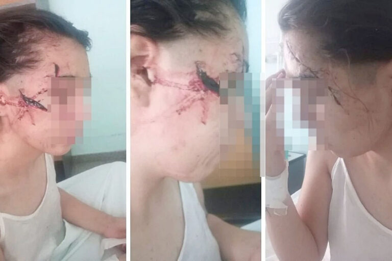 Horror en Santa Fe: una patota le desfiguró el rostro a cuchillazos a una chica de 15 años y detuvieron a dos menores