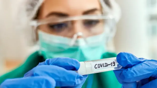 COVID-19: En el cierre de esta semana, se reportó una baja en los casos